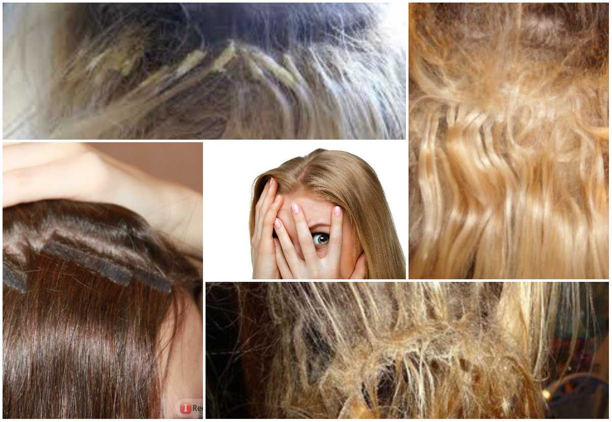 Возможные последствия наращивания волос и как уменьшить риск их появления. наращивание волос