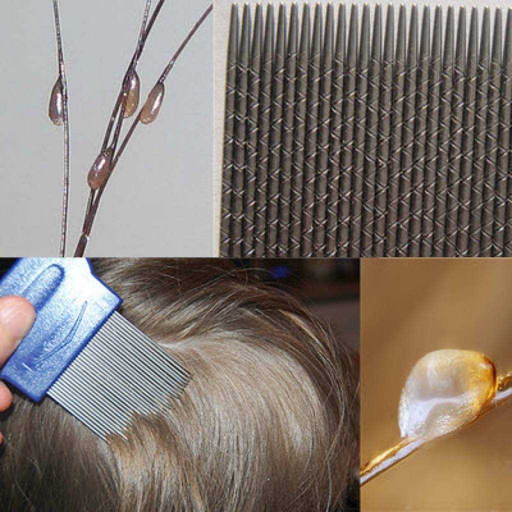 Окрашивание волос как способ избавиться от вшей
