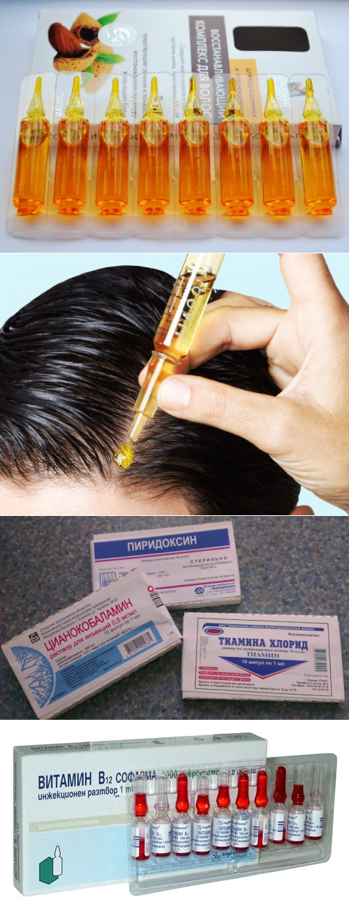 Какие витаминные уколы помогут от выпадения волос