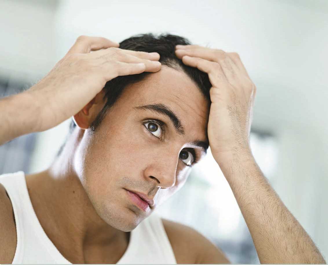 Выпадение волос у мужчин: причины и способы борьбы