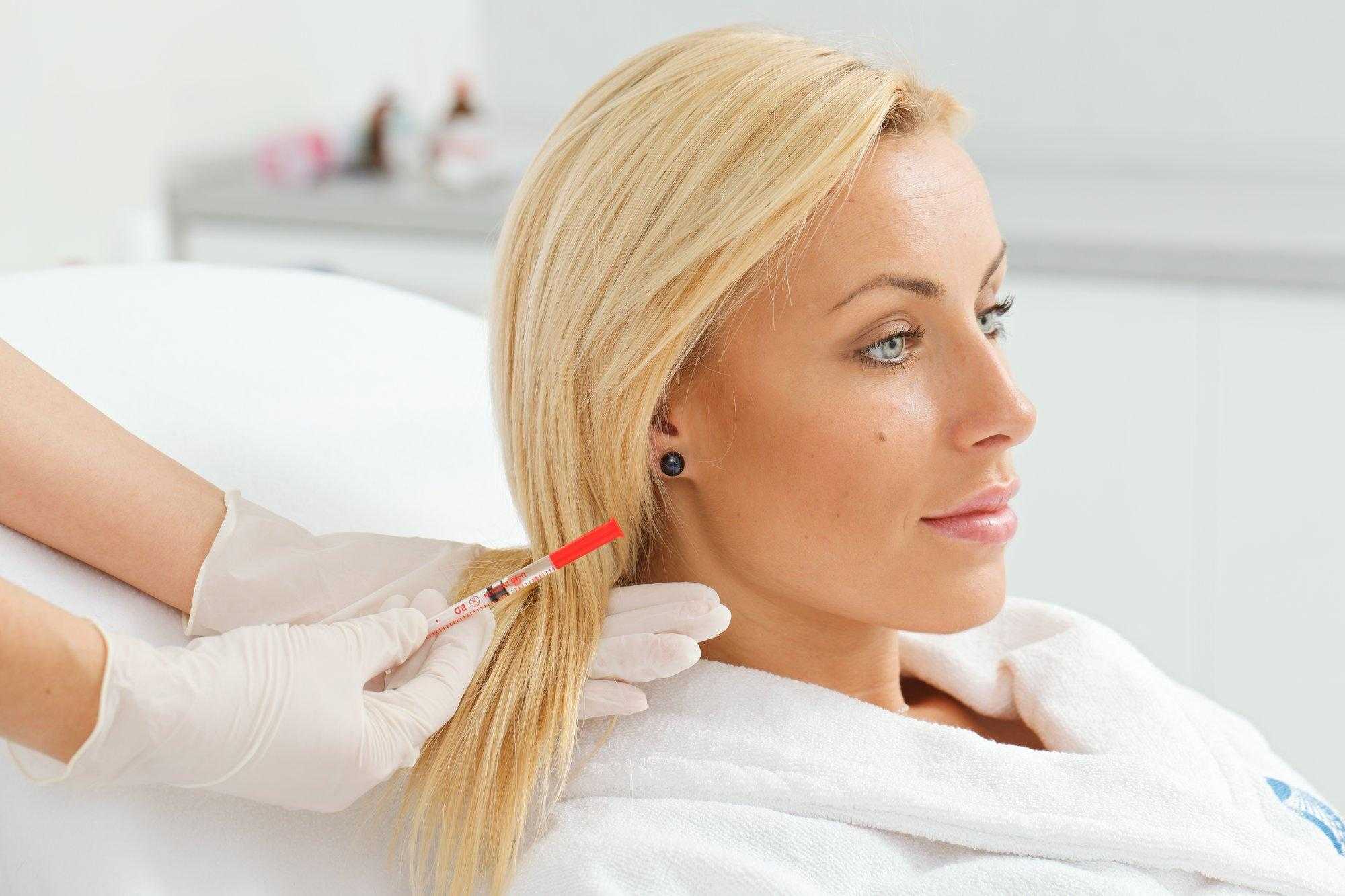 Мезотерапия для волос: сколько нужно сделать процедур