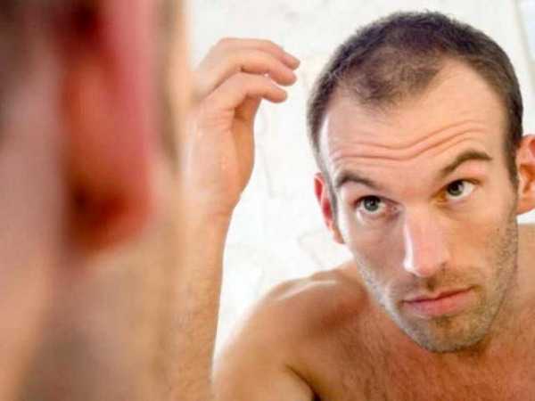 Потеря волос у мужчин тестостерон