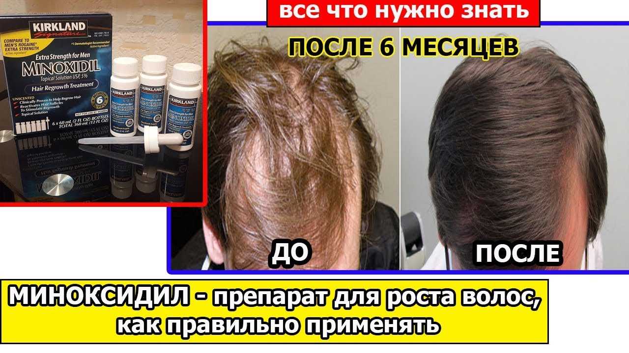 Генеролон: инструкция по применению спрея для волос и отзывы