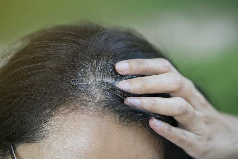 Как женщине остановить появление седины на волосах?
