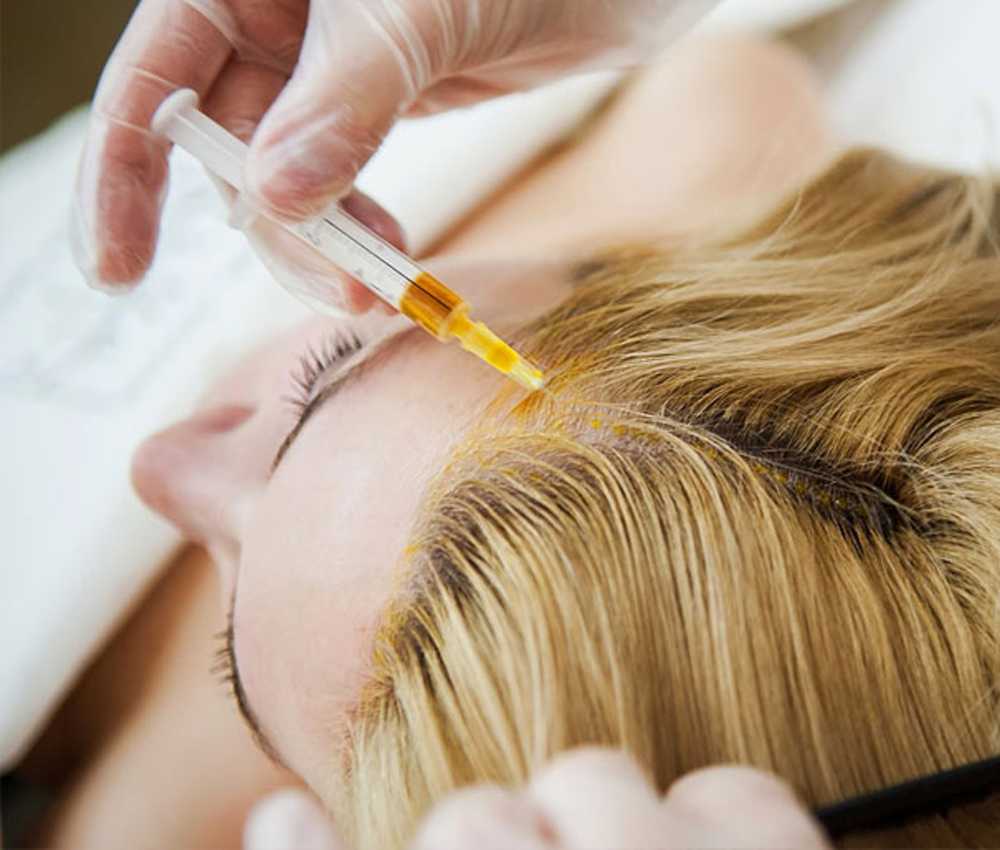 Мезотерапия для волос и кожи головы: отзывы, фото до и после, цена, препараты