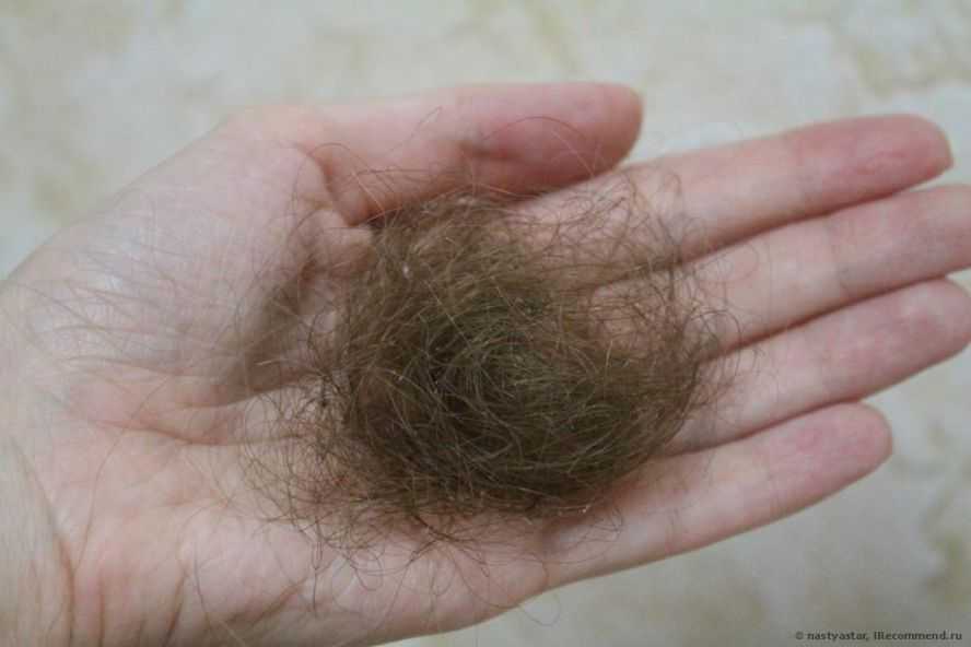 Выпадение волос у женщин: ежедневная норма и причины для беспокойства