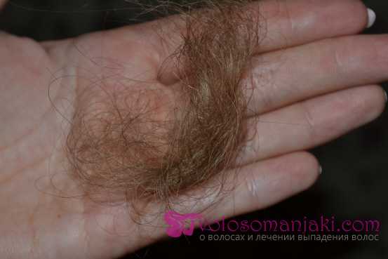 Сколько волос выпадает у человека при одном расчесывании