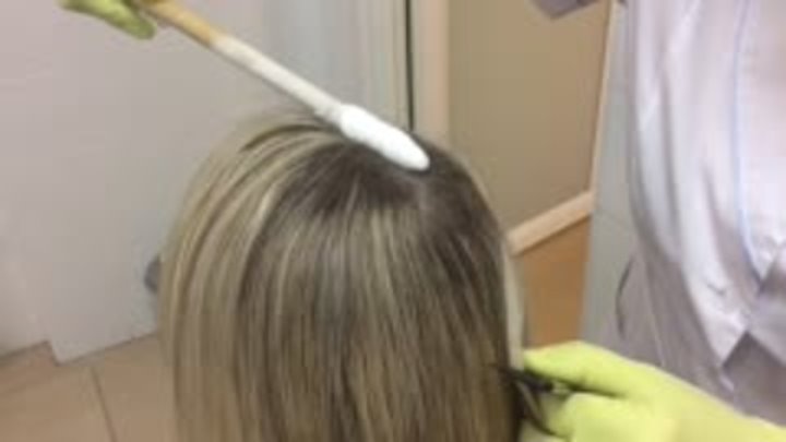 Криотерапия, как метод лечения волосистой кожи головы
