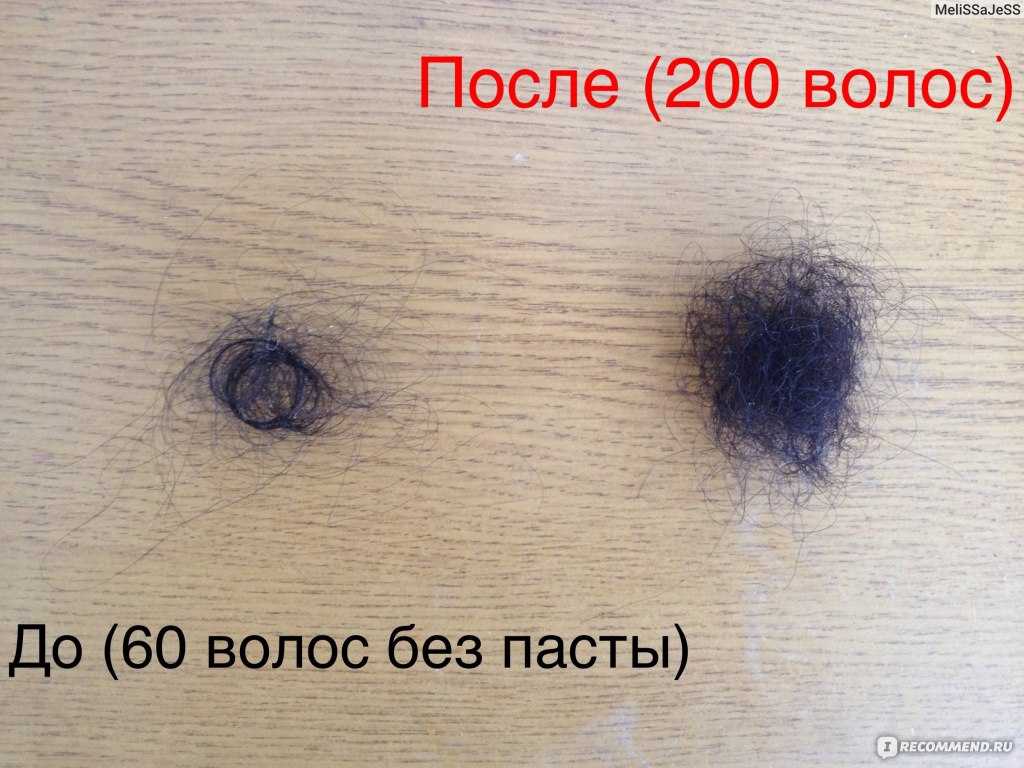 Сколько у человека выпадает в день волос