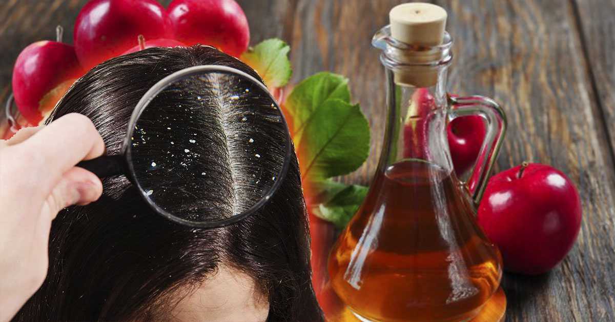 Как использовать яблочный уксус для волос?