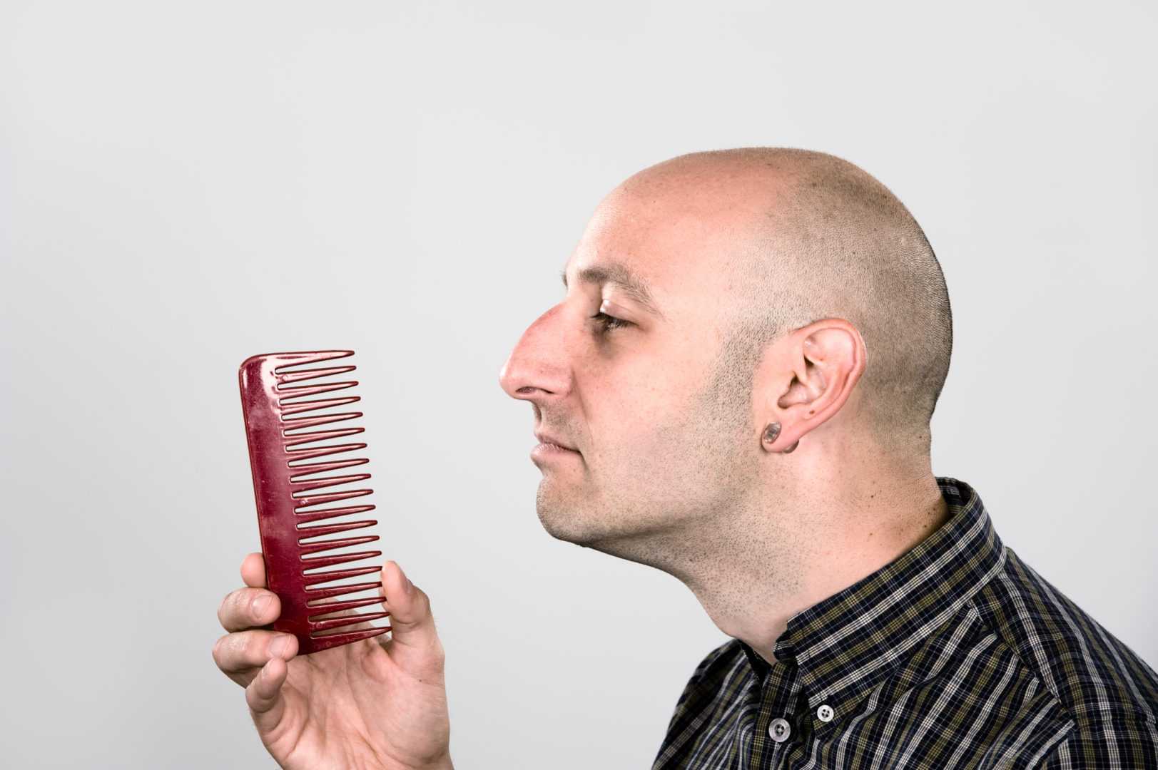 Причины выпадения волос у мужчин и эффективные методы восстановления густоты волосяного покрова