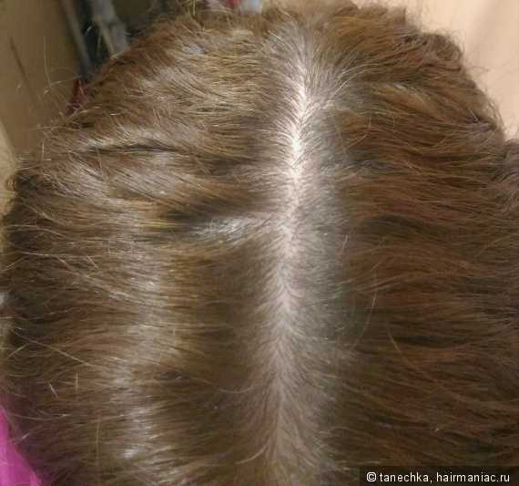 Какая норма выпадения волос в день у женщин?