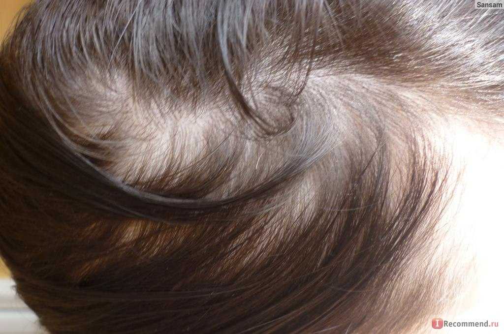 Как вернуть здоровье волосам после рождения малыша?