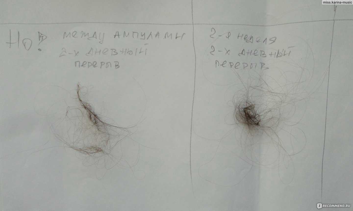 Норма выпадения волос в день у женщин и способы подсчета