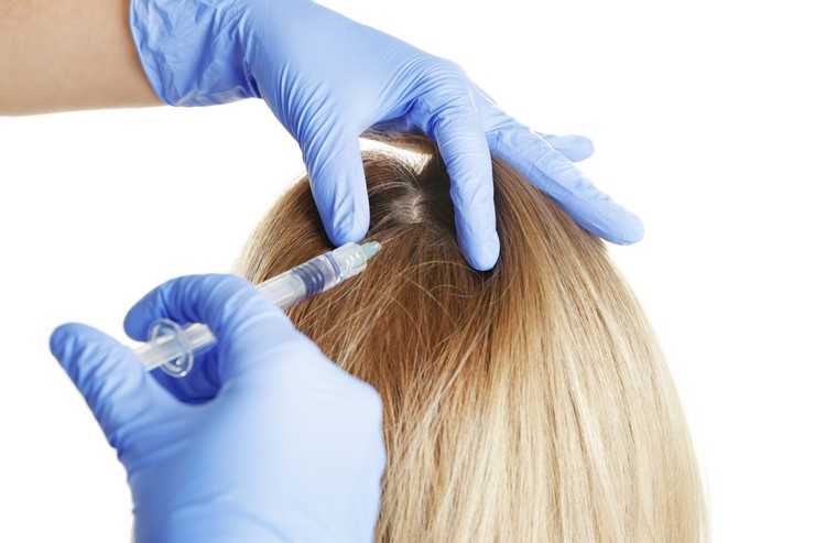 Криотерапия, как метод лечения волосистой кожи головы