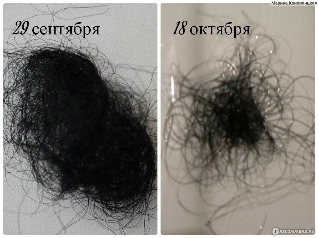 При мытье головы выпадает много волос. Норма выпадения волос. Норма выпадения волос у женщин. НАРИА выпадения волос в день. Норма выпадения волос в день у женщин.