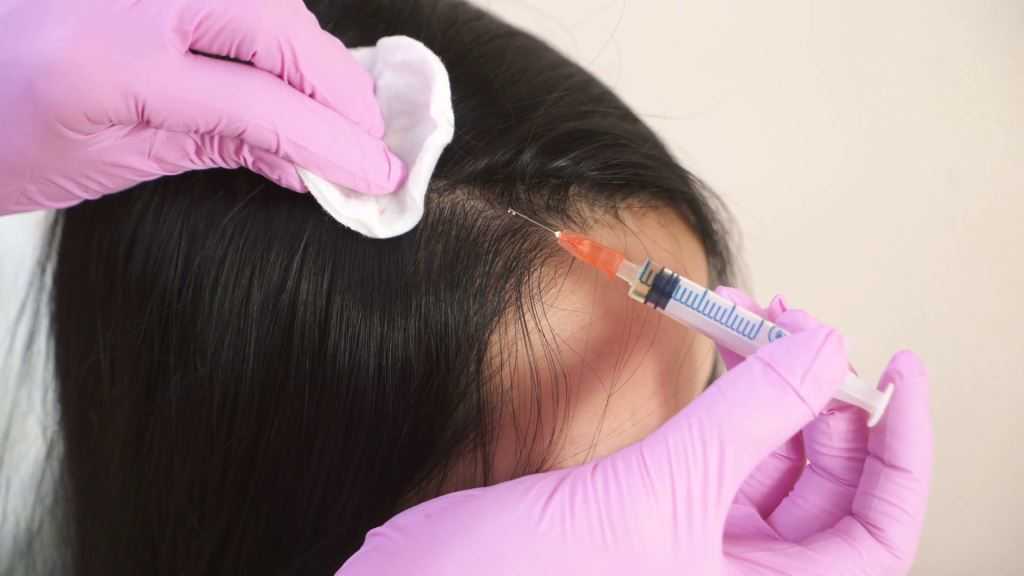 Все о мезатерапии волос: виды процедуры и рекомендации