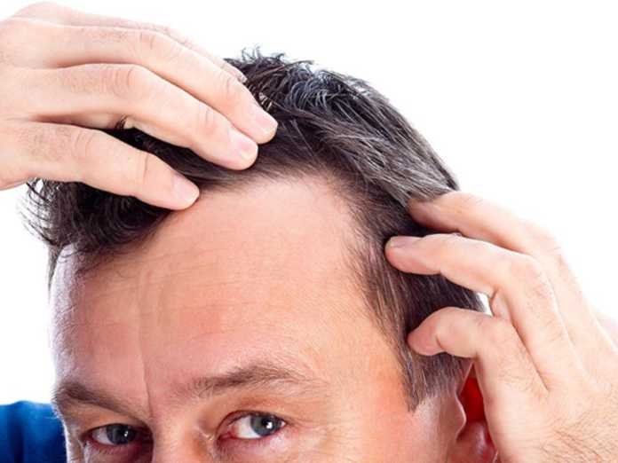 Как и чем лечить выпадающие волосы