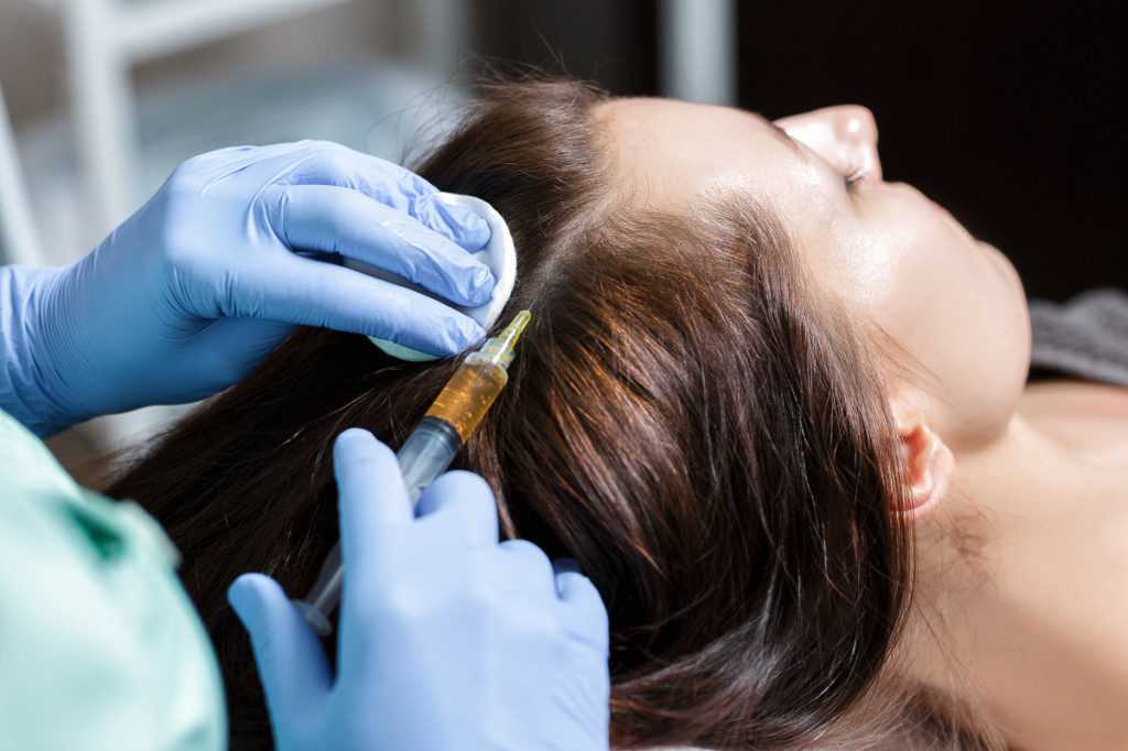 Лечение волос азотом – криотерапия