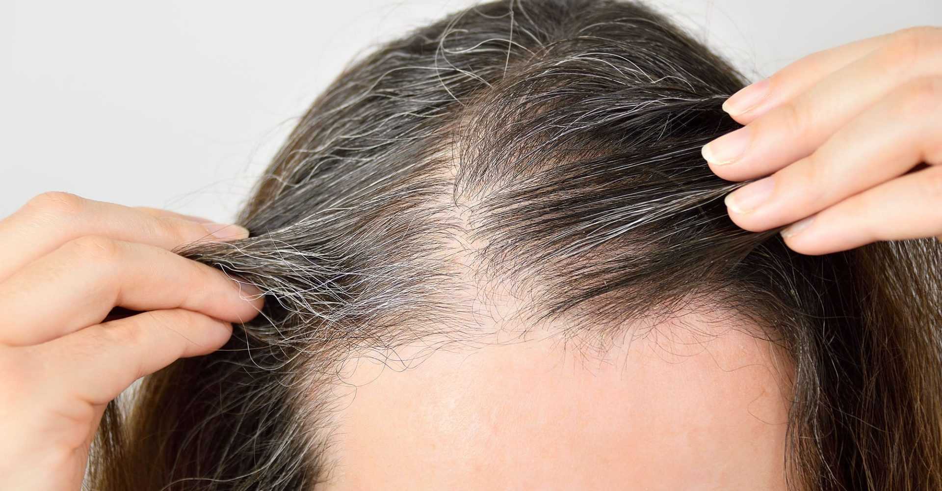 Ранняя седина волос: причины и лечение у женщин и у мужчин. почему появляется седина и как с этим бороться