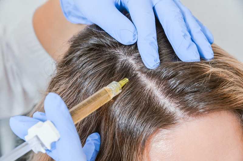 Мезотерапия для волос – что это такое и поможет ли остановить выпадение?