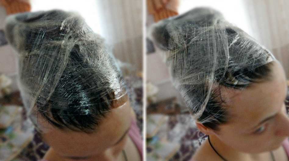 Советы трихолога: что делать при выпадении волос