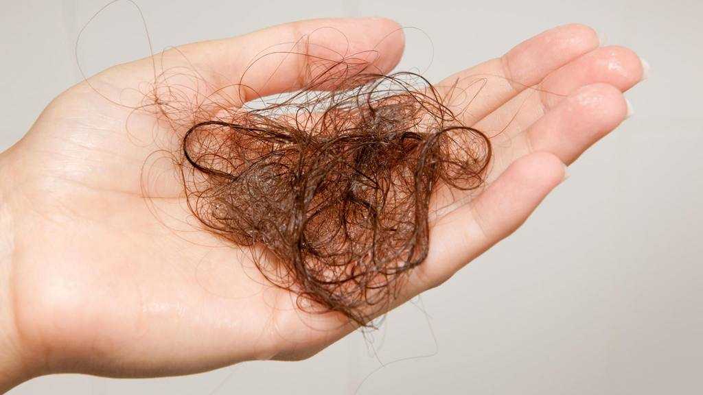 Норма выпадения волос в день для мужчин и женщин