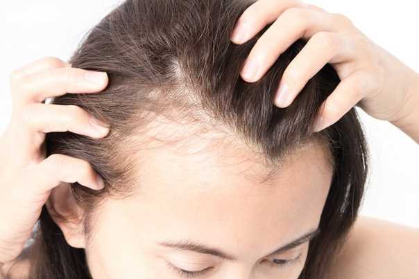 Остановить выпадение волос у женщин: как быстро предотвратить