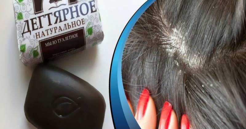 Дегтярное мыло для волос: отзывы о применении