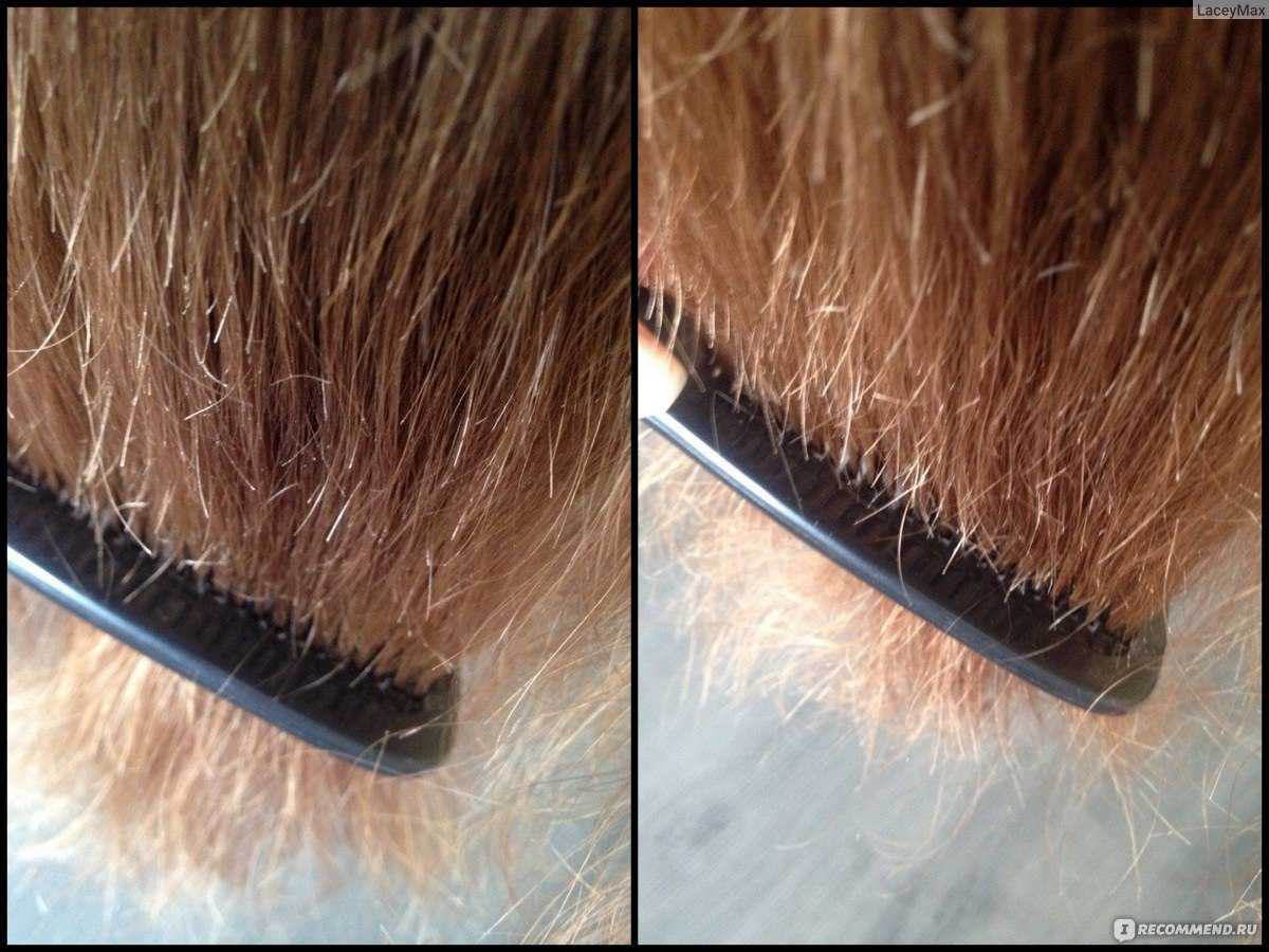 Почему секутся волосы: 7 суперсредств, которые их спасут (резать не придется)