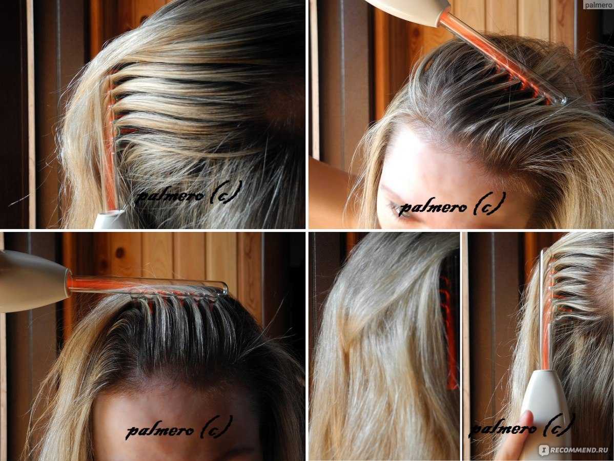 Дарсонваль для волос: принцип работы, противопоказания