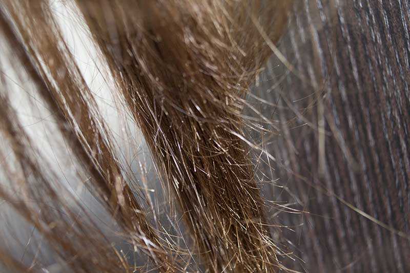 Причины и лечение секущихся волос