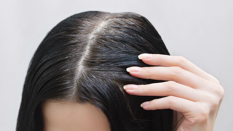 Как бороться с ранней сединой волос у женщин? правильное питание – верная дорога к борьбе с сединой. причины появления седых волос у женщин: физиологические и патологические