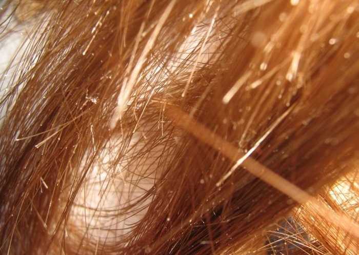 Способы лечения секущихся волос в домашних условиях