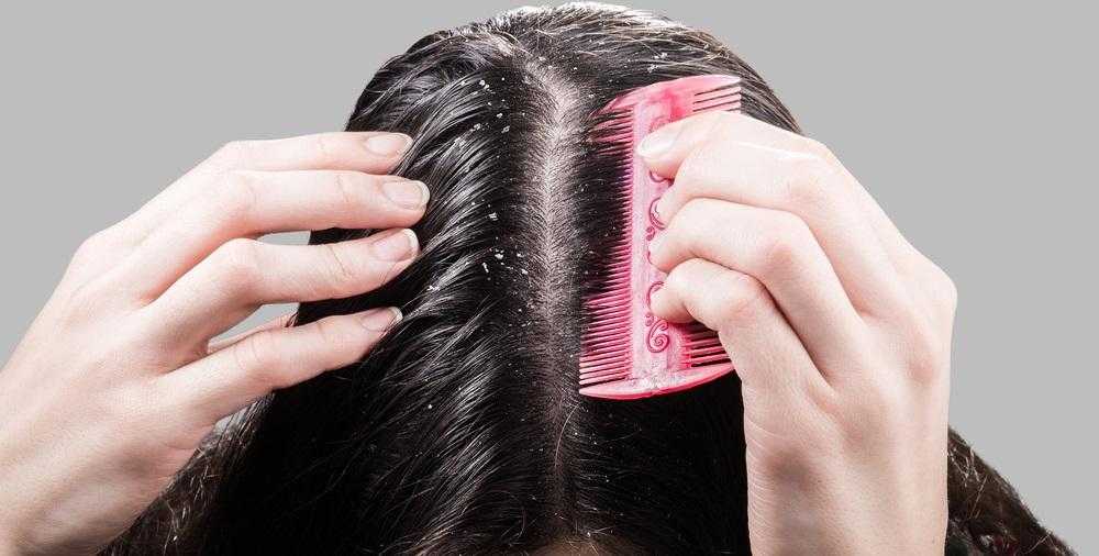 Проблемы волос и их решение. виды проблем с волосами и их решение