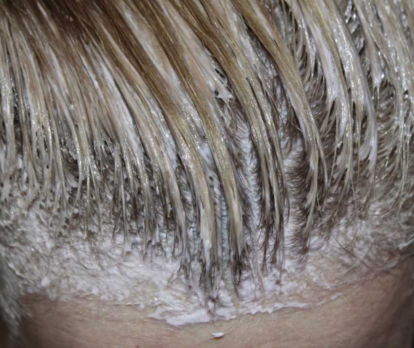 Очень сухая кожа головы: что делать, если шелушиться и выпадают волосы у взрослого – чем лечить зуд и сухость, после мытья