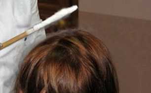 Чем полезна криотерапия для волос?
