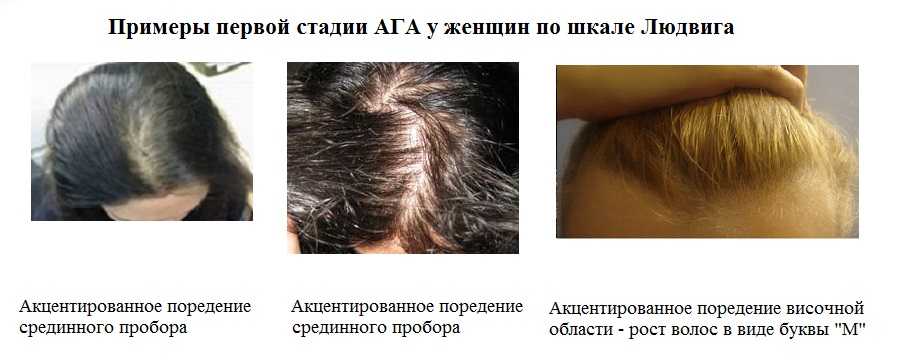 Самые эффективные средства против выпадения волос