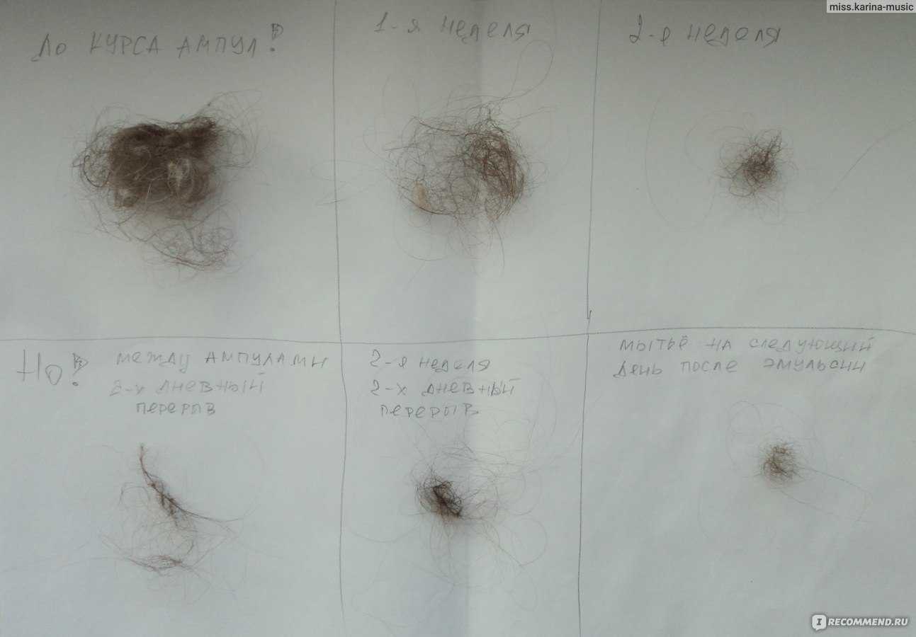 Почему выпадают волосы: норма и патология