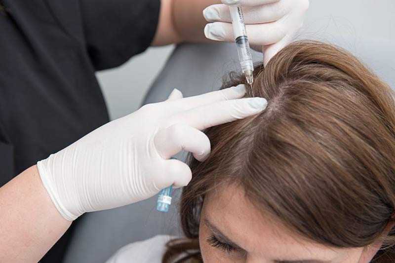 Лучшие средства для мезотерапии волос: какой препарат выбрать?