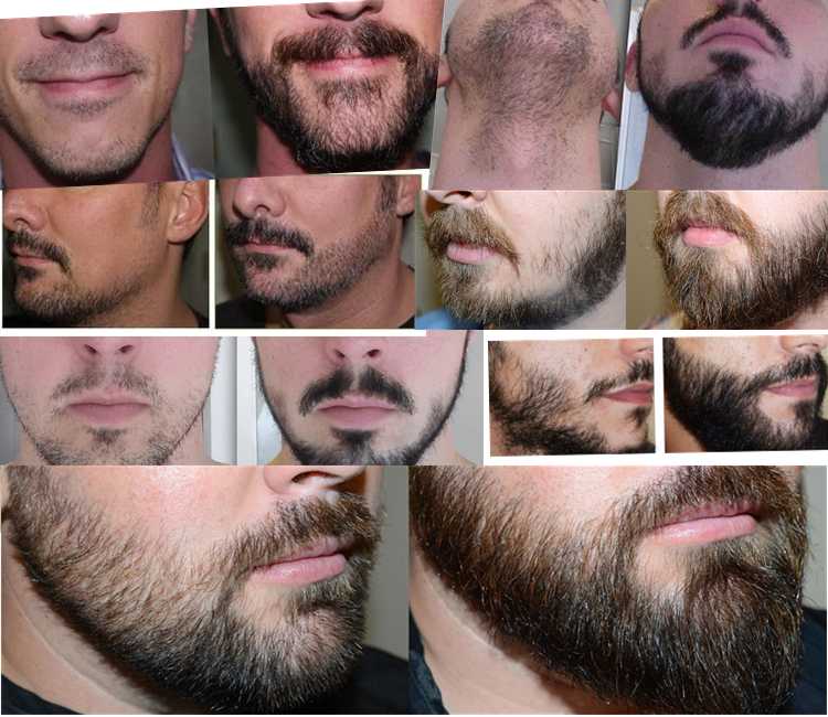 С какого возраста начинает расти борода?