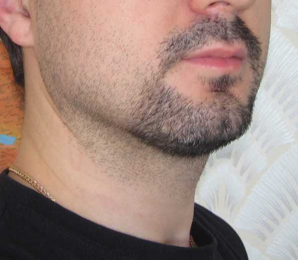 Борода эспаньолка (испанская бородка)