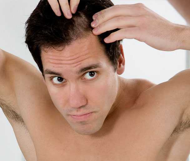 Дигидротестостерон и выпадение волос