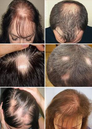 Как улучшить рост волос на голове. какие витамины пить для роста волос и какие маски для волос самые эффективные.