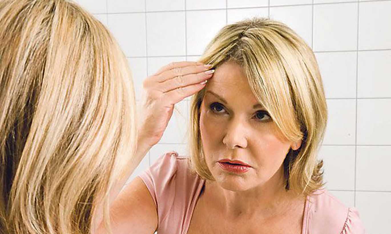 Выпадение волос при климаксе: как остановить, что делать с сильной алопецией, способы лечения