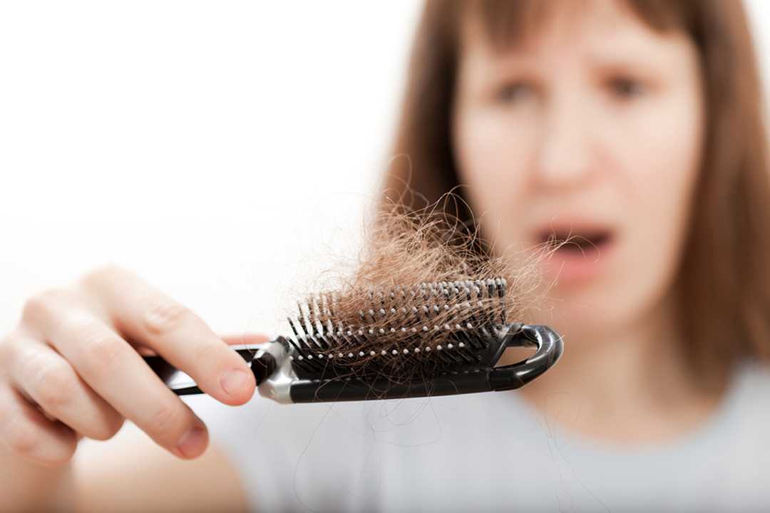 10 способов лечения сильного выпадения волос у женщин