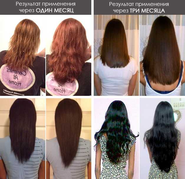 Спрей активатор для роста волос Ultra hair system: как работает, эффект после применения, плюсы и минусы
