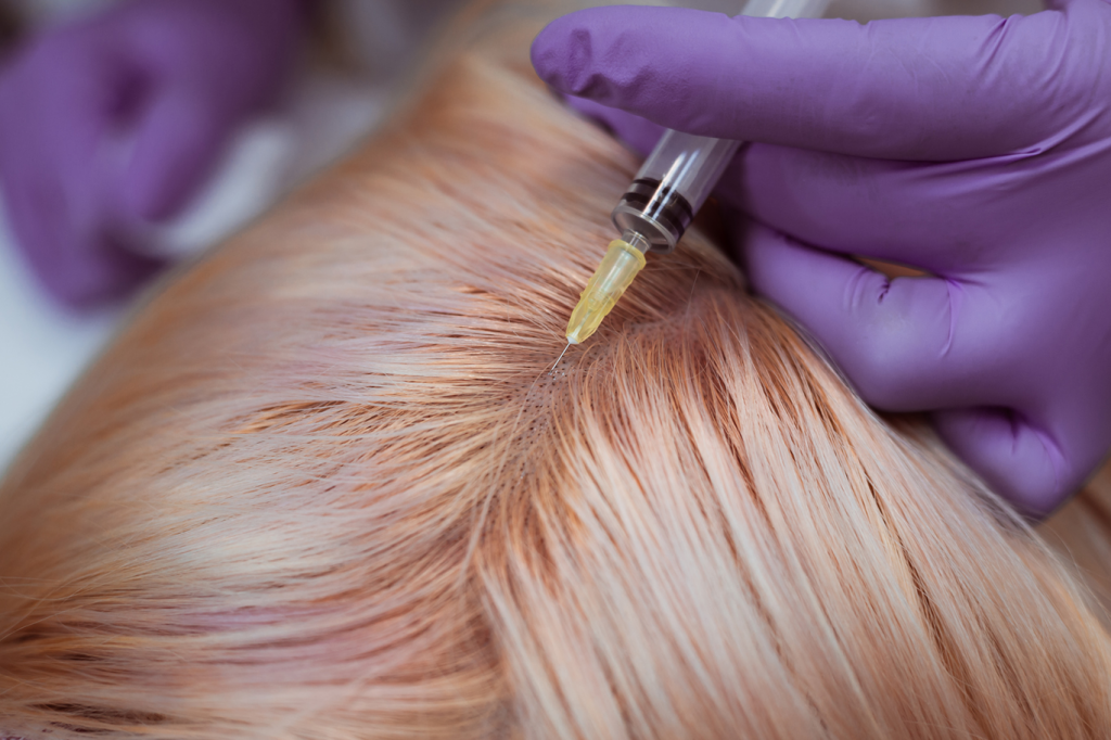Мезотерапия головы: уколы красоты для густоты и роста волос