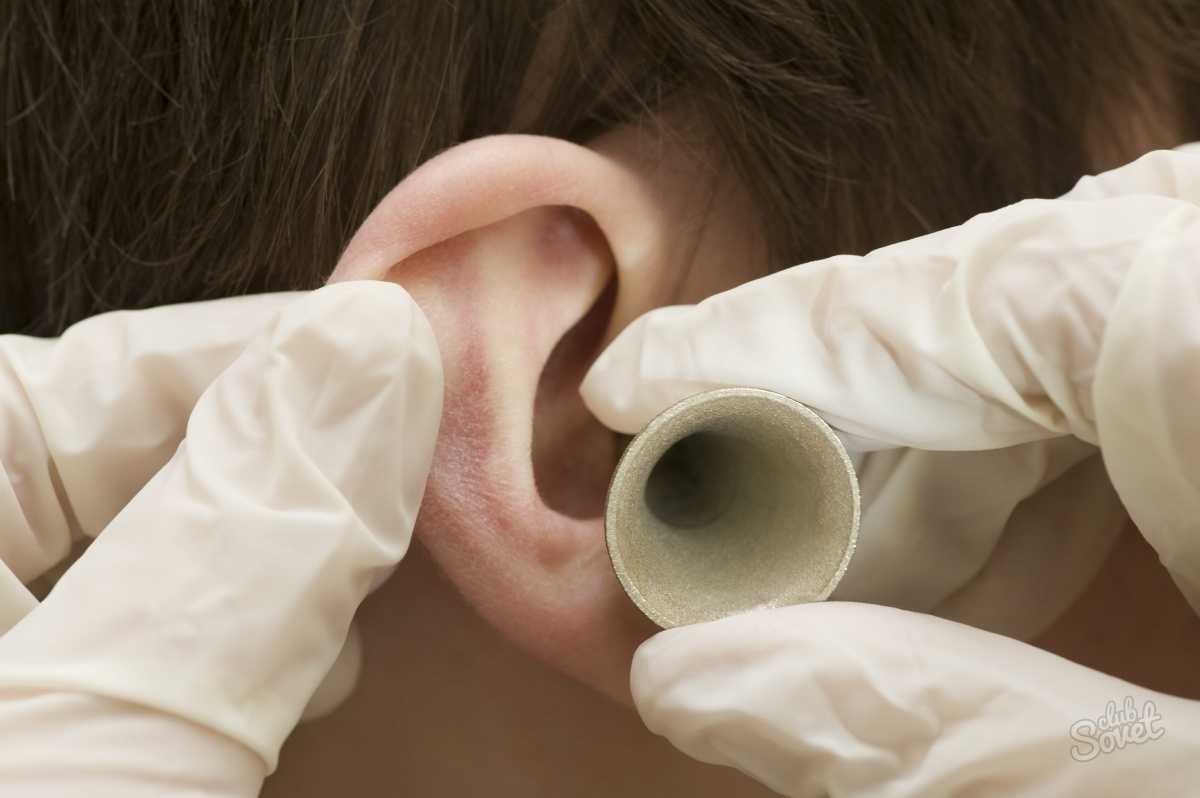 Шелушатся ушные раковины. шелушится кожа в ухе: основные причины и методы лечения как вы вылечили шелушение в ухе