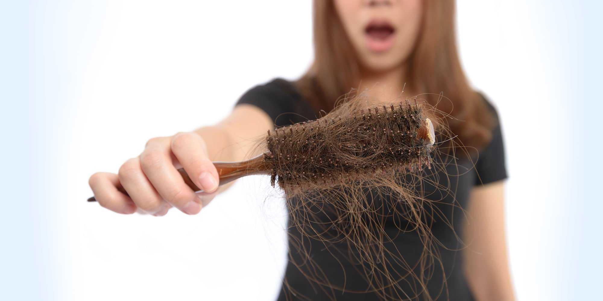 Выпадение волос у женщин – причины, диагностика, способы лечения